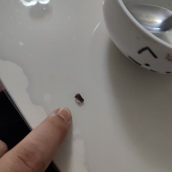 Bal Bademli Dondurmada Taş Bulunması Diş Ağrısına Yol Açtı