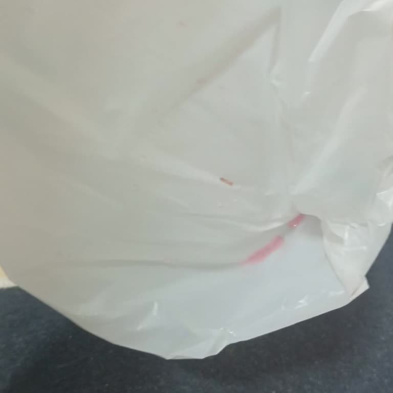 Kurye Paketi Düşürerek Çocuğumun Parmak Kesmesi Ve Müşteri Hizmetleri İlgisiz