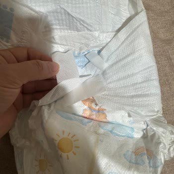 Molfix Bebek Bezinde Cırt Bant Sorunu Ve Sızıntı Şikayeti