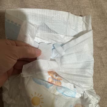 Molfix Bebek Bezinde Cırt Bant Sorunu Ve Sızıntı Şikayeti