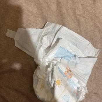 Molfix Bebek Bezinde Cırt Bant Sorunu Ve Sızıntı Şikayeti