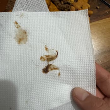 Migros’ta Ülker Probis Çikolatasında Böcek Ve Gıda Güvenliği Endişesi