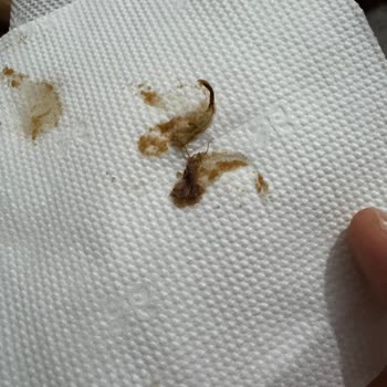 Migros’ta Ülker Probis Çikolatasında Böcek Ve Gıda Güvenliği Endişesi