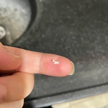 Böğürtlen Aromalı Sakızda Yabancı Parça Tespiti, Hijyen Endişesi Ve Tazminat Talebi