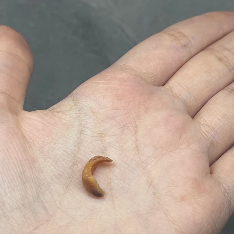 Maydonoz Döner’de Dürümdeki Büyük Kemik Parçası Hayati Tehlike Yarattı