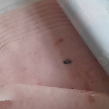 Namet Hindi Jambon Ürününde Tekrar Yabancı Cisim Ve Geri Dönüş Yok