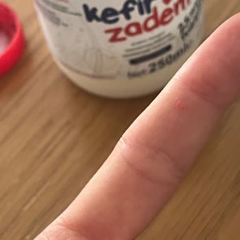 Kefirde Plastik Parça Bulunması Sağlık Korkusu