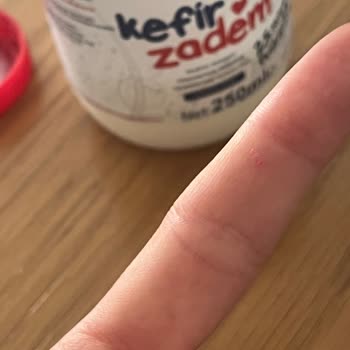 Kefirde Plastik Parça Bulunması Sağlık Korkusu