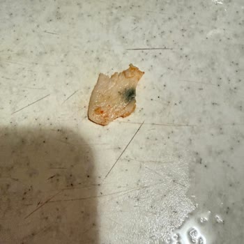 Müşteri Sağlığı Tehlikede: Küflü Döner Ve Eksik İade