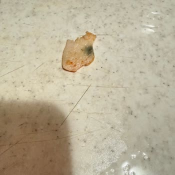 Müşteri Sağlığı Tehlikede: Küflü Döner Ve Eksik İade