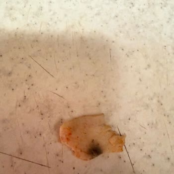 Müşteri Sağlığı Tehlikede: Küflü Döner Ve Eksik İade