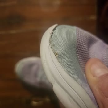 Skechers Ayakkabısının Dikişlerinin Kısa Sürede Patlaması Ve Haksız Red Yanıtı