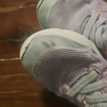 Skechers Ayakkabısının Dikişlerinin Kısa Sürede Patlaması Ve Haksız Red Yanıtı