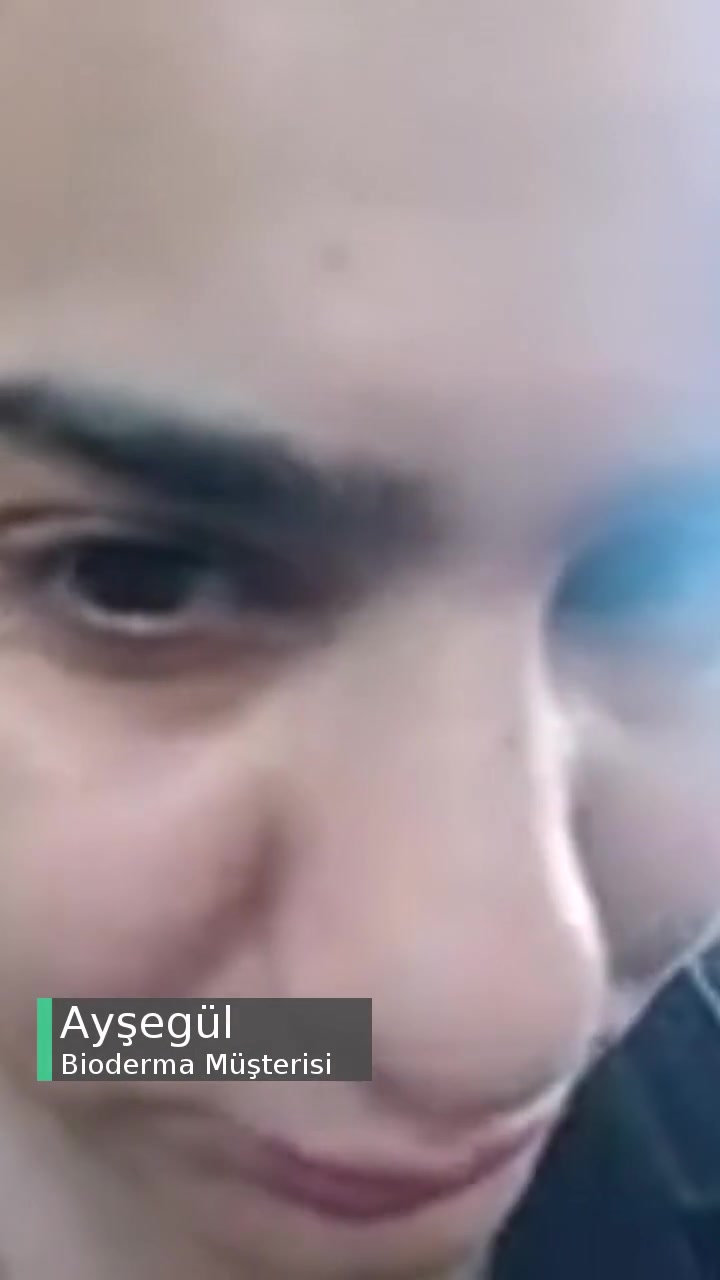 Bioderma Ürün Yüzümü Kuruttu, Daha Kötü Yaptı! videonun kapak resmi
