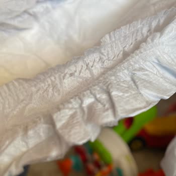 Molfix Junior Bezinde Boncukların Deriye Yapışması Ve Pamuk Bölümünün Yırtılması