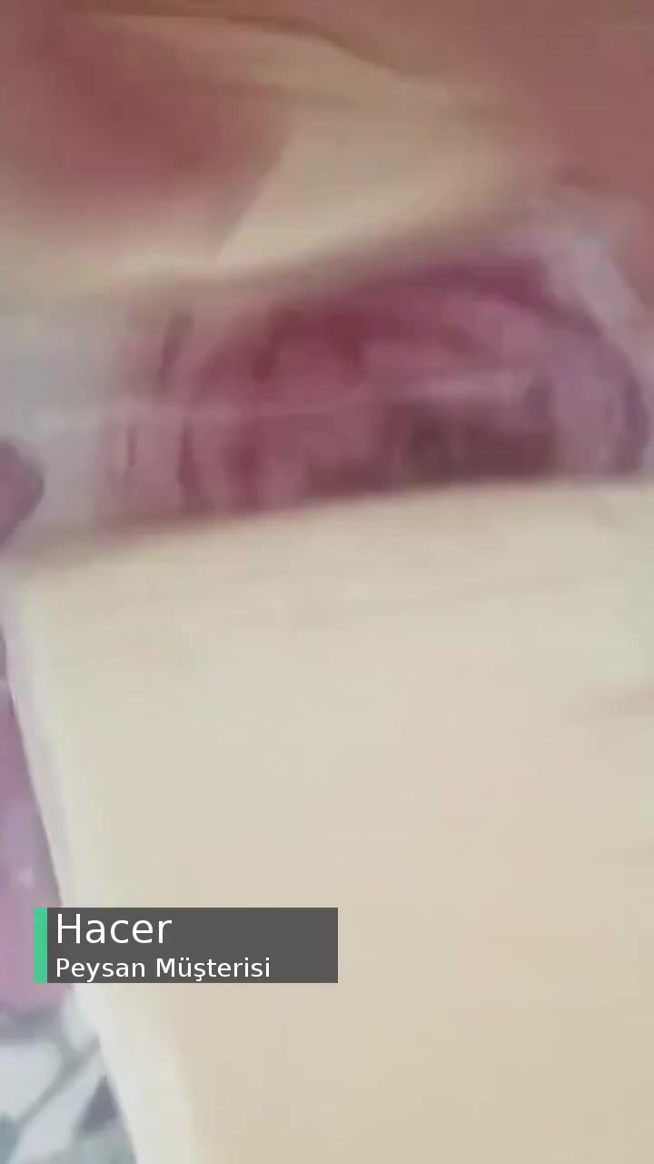 Peysan Peynirde Pembe Renk Şikayeti! videonun kapak resmi