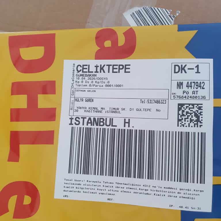 DHL Kargo’da Kayıp 25.000 TL’lik Protez Saç Ünitesi Ve Çözüm Eksikliği