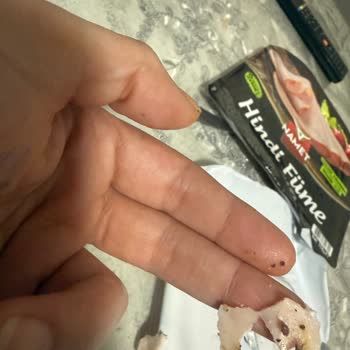 Namet Hindi Fümede Kurt Bulunması Hijyen Ve Güven Sorunu