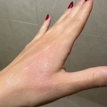 Peros Amberli Yumuşatıcısına Alerjik Reaksiyon Ve Uyarı Eksikliği