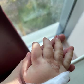 İnegöl Devlet Hastanesi Çocuk Servisinde Hemşire İhmali Ve İlgisizlik