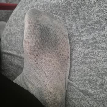 İnci Ayakkabım Boya Veriyor Ve Çözüm Bekliyor