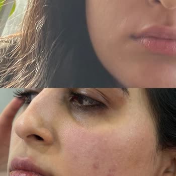 Uzm. Dr. Pelin Demirel Bulut Tedavi Edeceğiz Diye Beni Oyalayıp Geliştirdiler