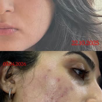 Uzm. Dr. Pelin Demirel Bulut Tedavi Edeceğiz Diye Beni Oyalayıp Geliştirdiler