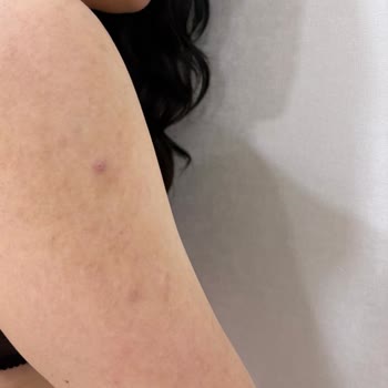 Uzm. Dr. Pelin Demirel Bulut Tedavi Edeceğiz Diye Beni Oyalayıp Geliştirdiler