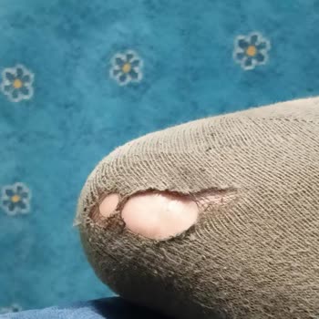 Reebok Ayakkabısında Üçüncü Ayda Deformasyon Ve Değişim İsteği