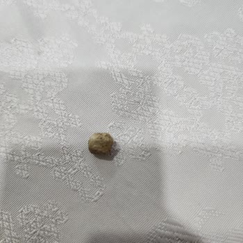 Yayla Nohut Ürünün İçinden Çıkan Taş Diş Hasarına Yol Açtı