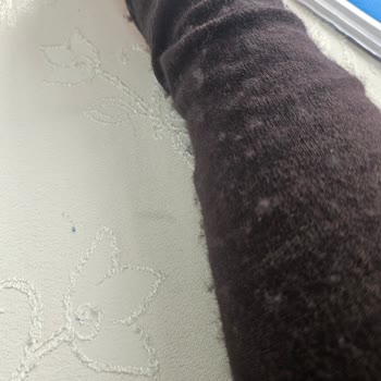 İlk Kullanımda Yoğun Tüylenme Yaşadım Ve İade Talebim Haksızca Reddedildi