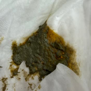 Holle Organik Keçi Sütü İle Bebeğimde Şiddetli Sancılanma, İştahsızlık Ve Kabızlık