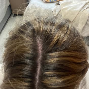 Saç Renginde Hatalı Uygulama Ve Eksik İade