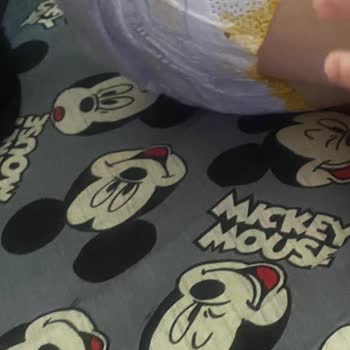 Prima Premium Care Bebek Bezinde Sızdırma Sorunu Ve İade Talebi