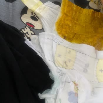 Prima Premium Care Bebek Bezinde Sızdırma Sorunu Ve İade Talebi