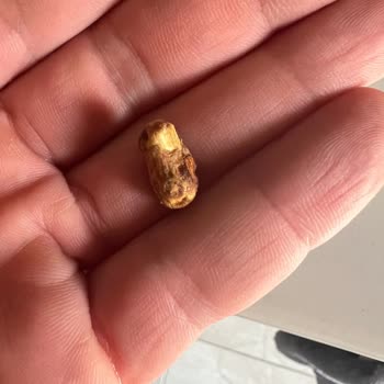 Migros Antep Fıstıklı Züber Barında Çıkan Sert Yabancı Cisim Diş Kırılmasına Yol Açtı