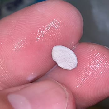 Sütaş Ayran Şişesinde Yabancı Parça: Sağlık Endişesi