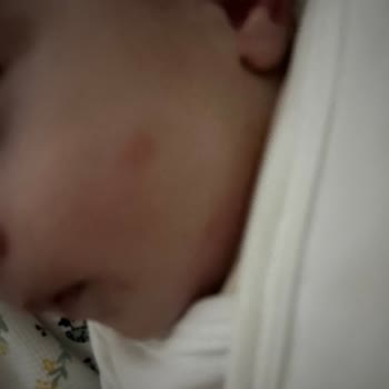 Bebelac Gold Konfor’da Alerjik Reaksiyon Ve İade Talebi