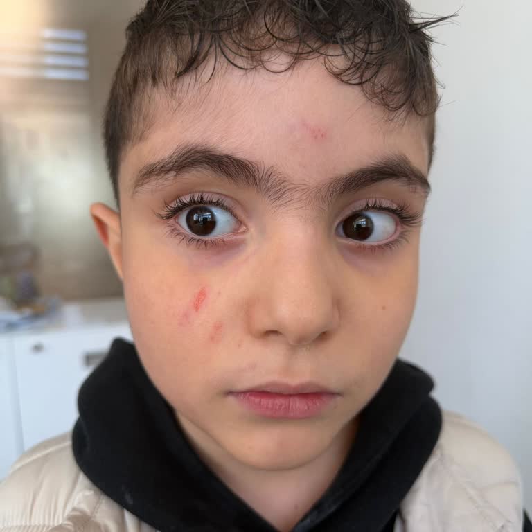 Okulda Şiddetli Fiziksel Saldırılar, Müdahale Eksikliği Ve İade Talebi