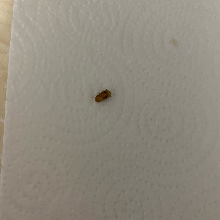 Getir Tatlısında Sert Yabancı Madde Çıktı, Sağlık Riski Ve İade Reddi