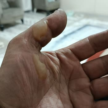 Yangın Çıkan Scooter, Evde Büyük Zarar Ve Umursamaz Müşteri Temsilcisi