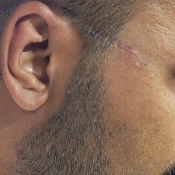 Sağlığımı Bozan Çerçeve Ve Saygısız Personel Nedeniyle İade Talebi