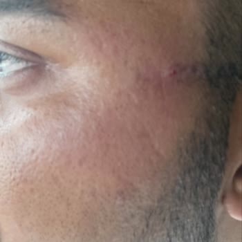 Sağlığımı Bozan Çerçeve Ve Saygısız Personel Nedeniyle İade Talebi
