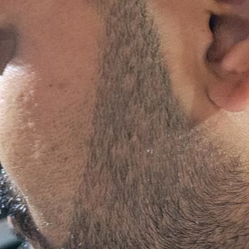 Sağlığımı Bozan Çerçeve Ve Saygısız Personel Nedeniyle İade Talebi