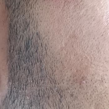 Sağlığımı Bozan Çerçeve Ve Saygısız Personel Nedeniyle İade Talebi