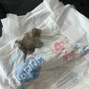 Molfix Bebek Bezinde Siyah Yapışkan Madde Ve Hijyen Sorunu