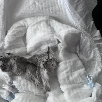 Molfix Bebek Bezinde Siyah Yapışkan Madde Ve Hijyen Sorunu