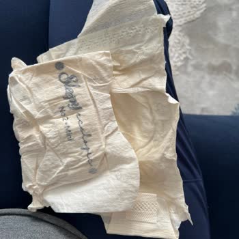 Sleepy Ecologic Premium Plus Bebek Bezinde Cırt Cırt Parçası Eksik