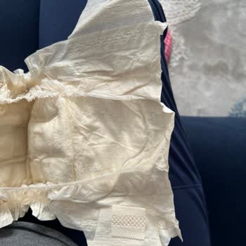 Sleepy Ecologic Premium Plus Bebek Bezinde Cırt Cırt Parçası Eksik