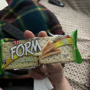 Migros Bisküvi İçinde Taş Parçası Nedeniyle Diş Kırılması Ve 5.000 TL Tedavi Masrafı Talebi